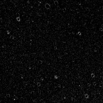 Upper left difference