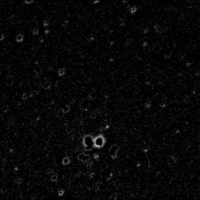 Upper right difference